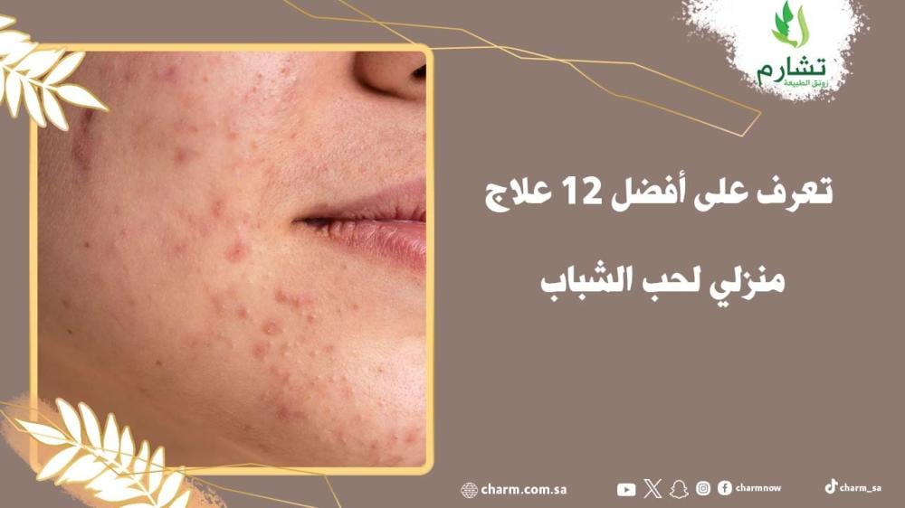 تعرف على أفضل 12 علاج منزلي لحب الشباب