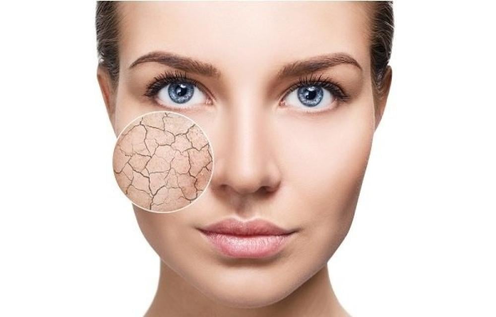 روتين العناية بالبشرة الجافة