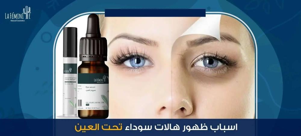 تعرفي على أسباب ظهور هالات سوداء تحت العين