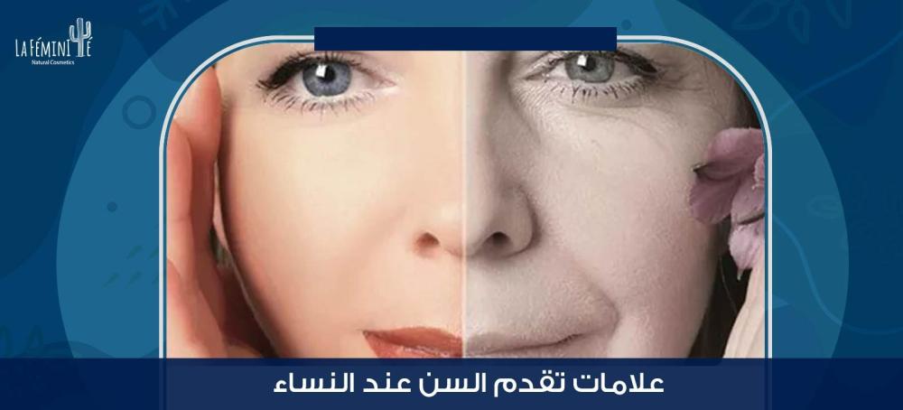 تعرفِ على علامات تقدم السن عند النساء وطريقة علاجها