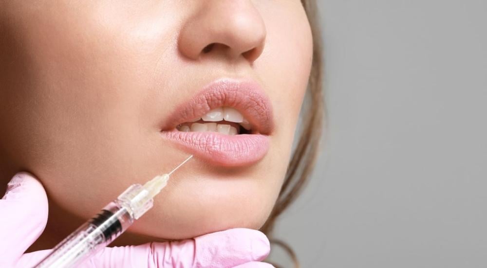 Lip filler