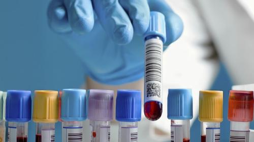 باقة الفحص الشامل الدوري (7 تحاليل)