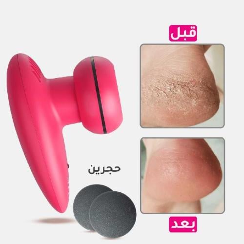 جهاز كينو لإزالة تشققات القدم وتكلس الكعب شحن USB...