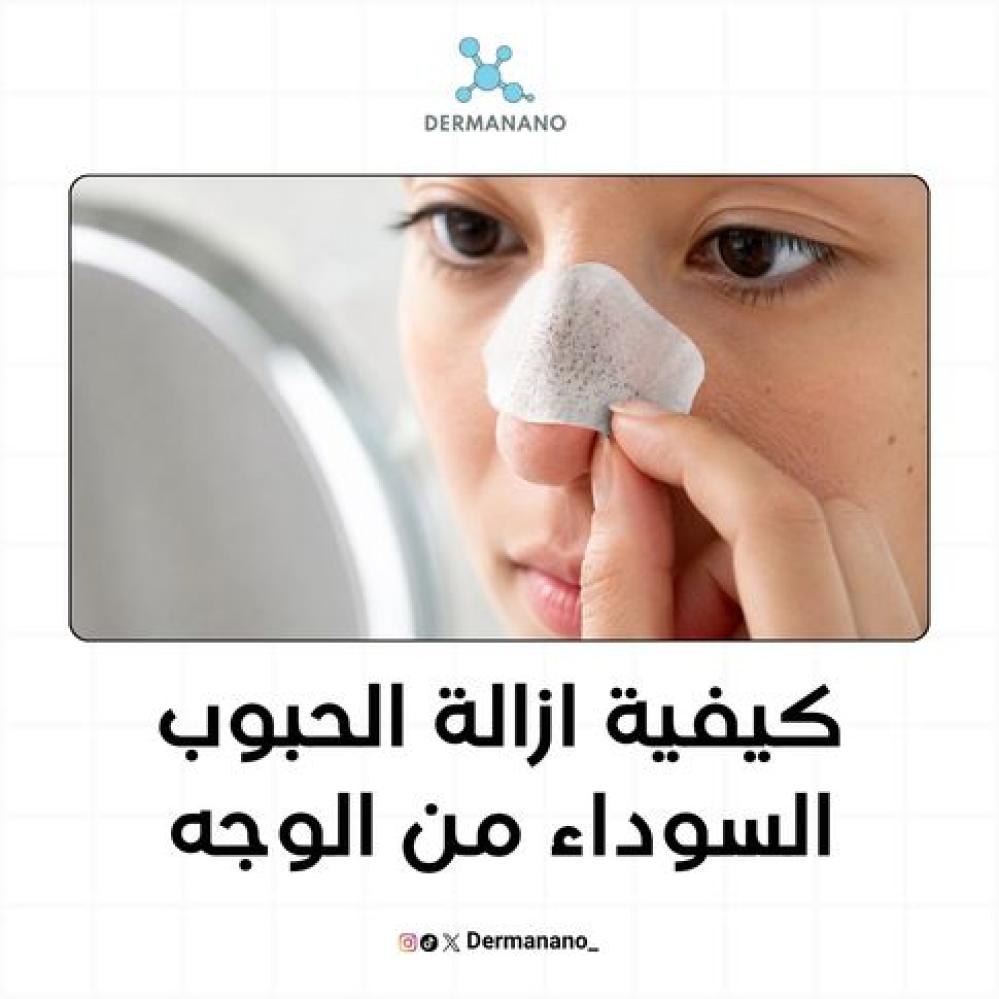 كيفية ازالة الحبوب السوداء من الوجه: الأسباب وروتين العلاج المناسب لكل نوع بشرة