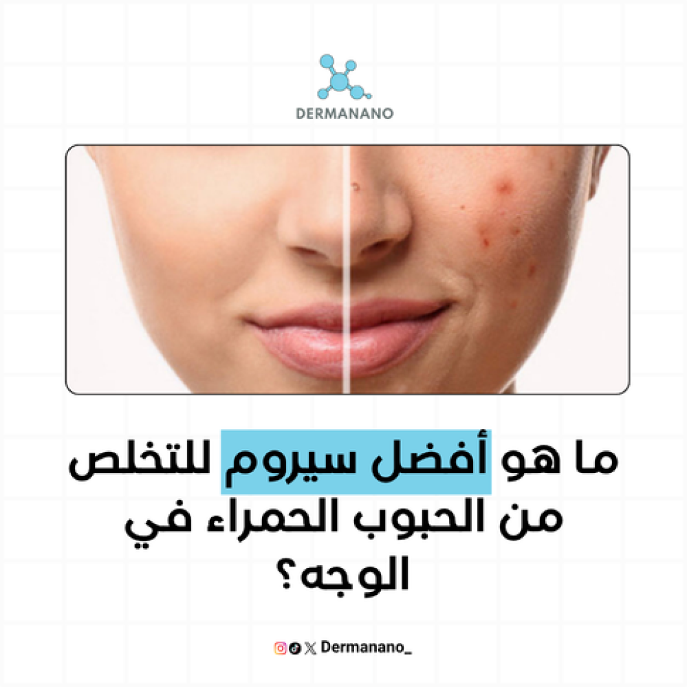 أسباب ظهور الحبوب المؤلمة في الوجه وأفضل طرق التعامل معها