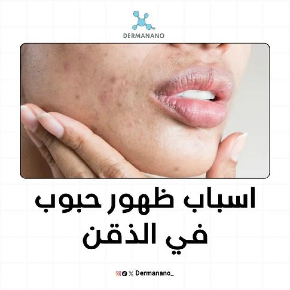 اسباب ظهور حبوب في الذقن وأهم أسبابها وطرق علاجها