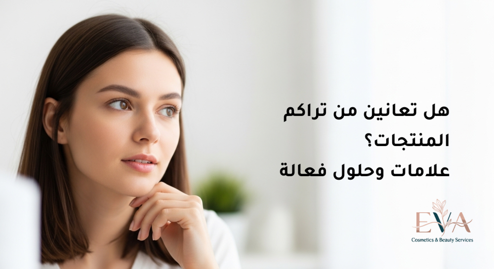 تراكم المنتجات