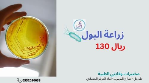 زراعة البول