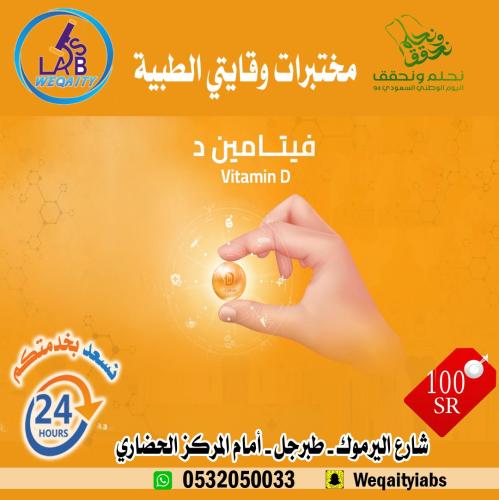 فحص فيتامين د