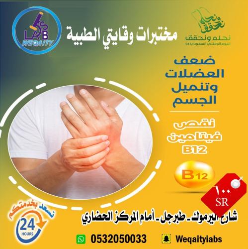 فحص فيتامين B12