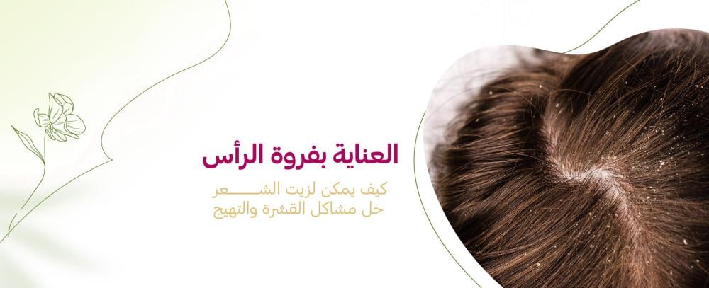 كيفية التخلص من قشرة الشعر والحكة نهائيًا بطرق طبيعية وآمنة - رواء