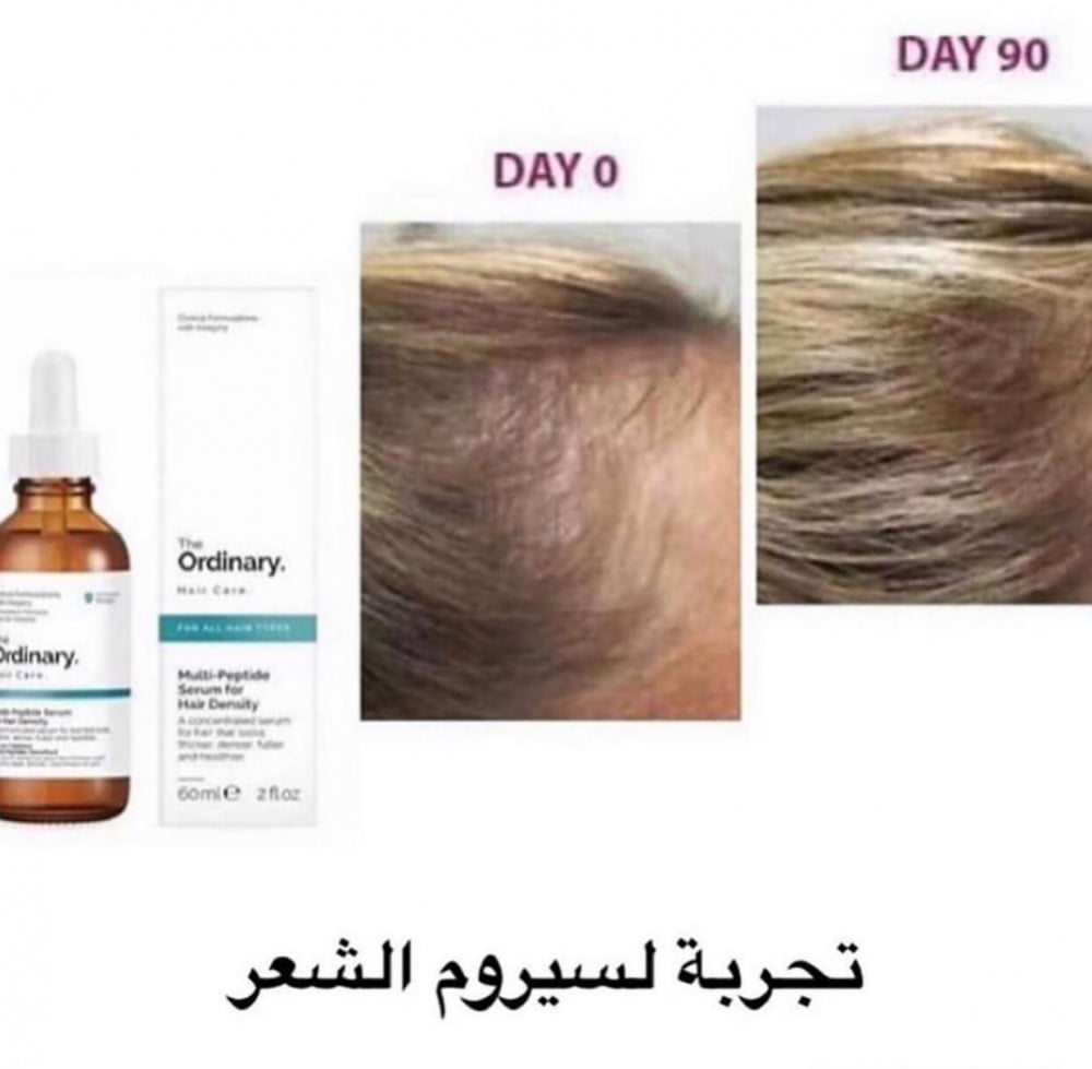 سيروم ملتي ببتيد لكثافة الشعر من ذا اورديناري the ordinary multi peptide serum for hair density 60ml متجر الفراوله عروض الفراوله