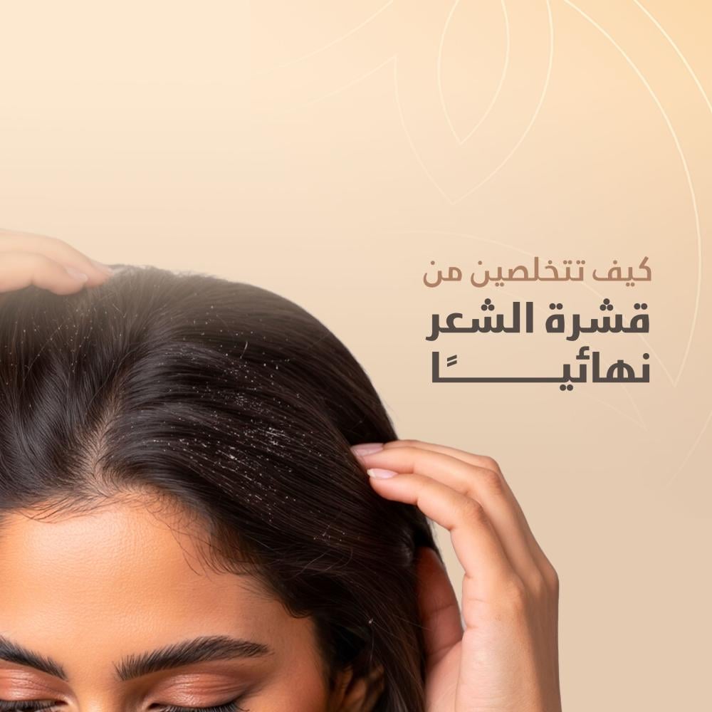 كيف تتخلصين من قشرة الشعر نهائيًا؟ دليل شامل للحلول الجذرية