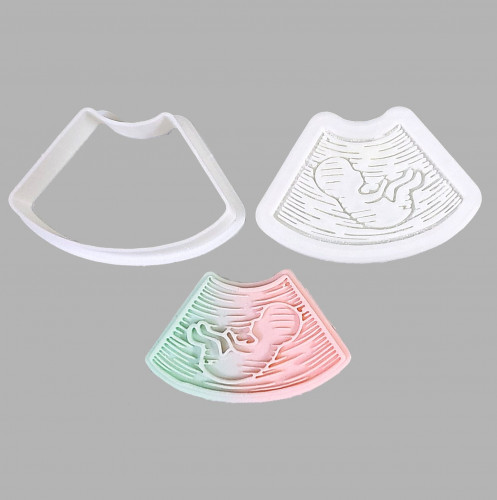 قطاعة و ختم صورة البيبي بالامواج الصوتية