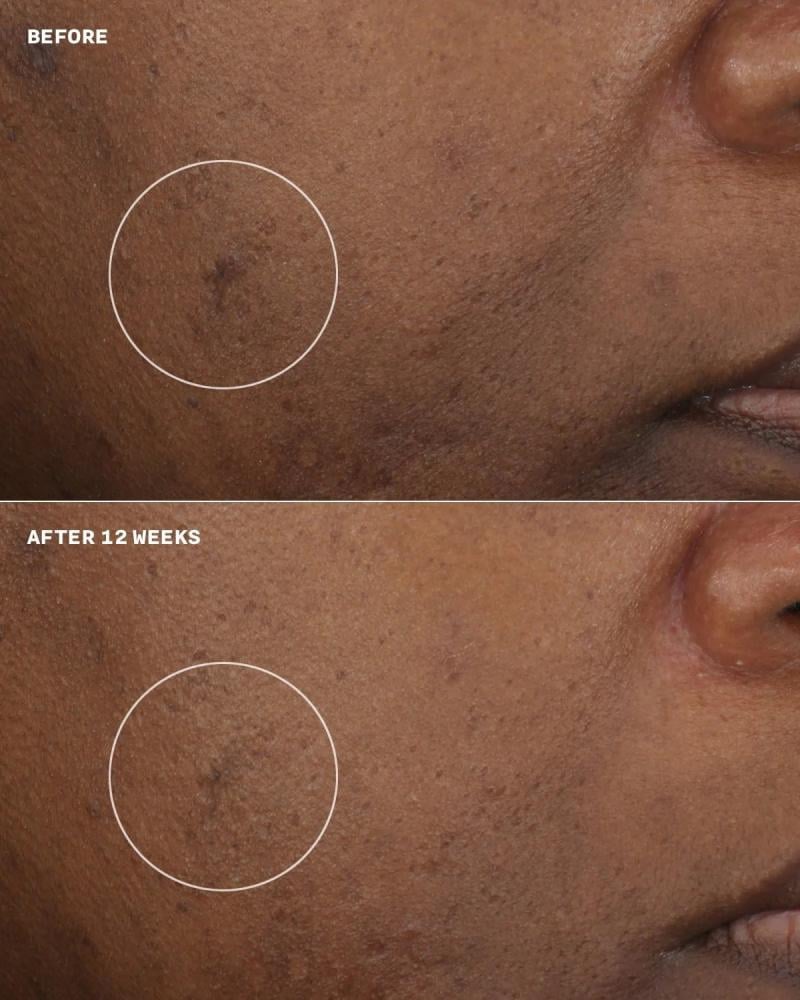 مرطب ومصحح لون البشرة إيفين بيتر بعامل حماية SPF 20 من إستي لودر - 50ml