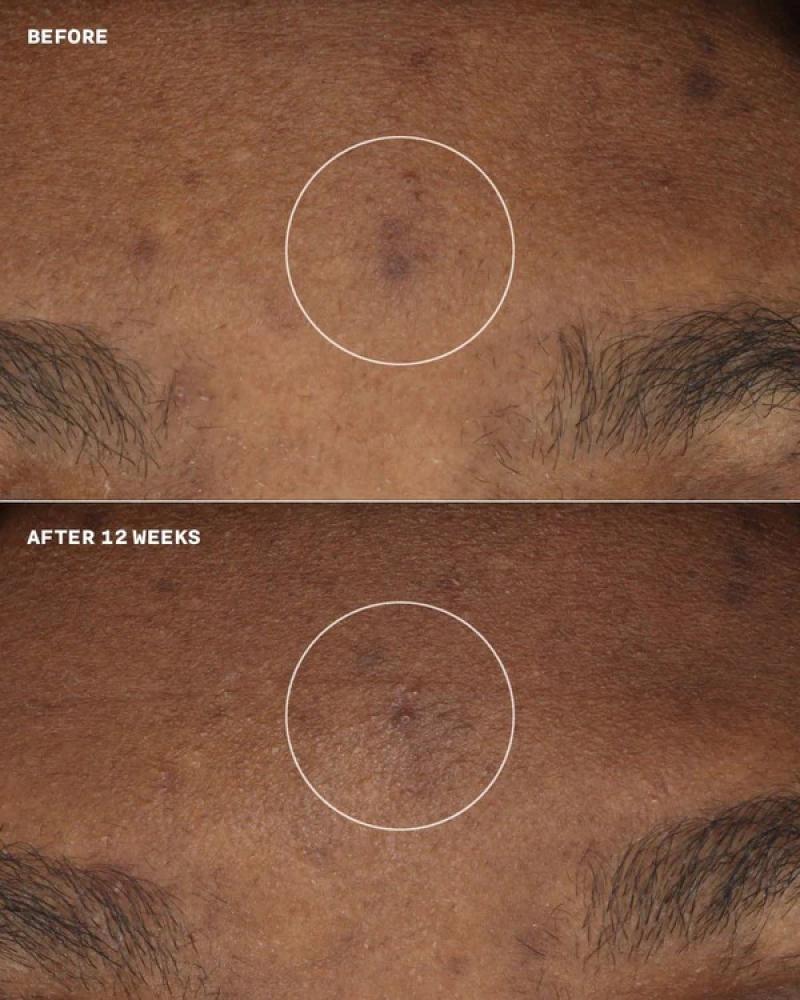 مرطب ومصحح لون البشرة إيفين بيتر بعامل حماية SPF 20 من إستي لودر - 50ml