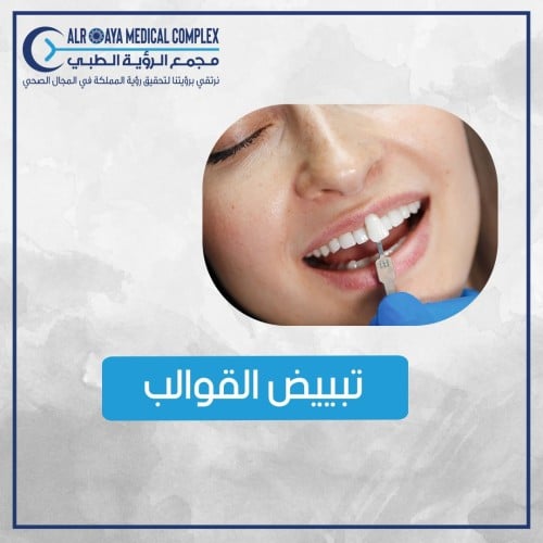تبيض القوالب لمنزلية
