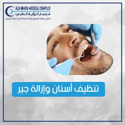 تنظيف الأسنان وازالة جير