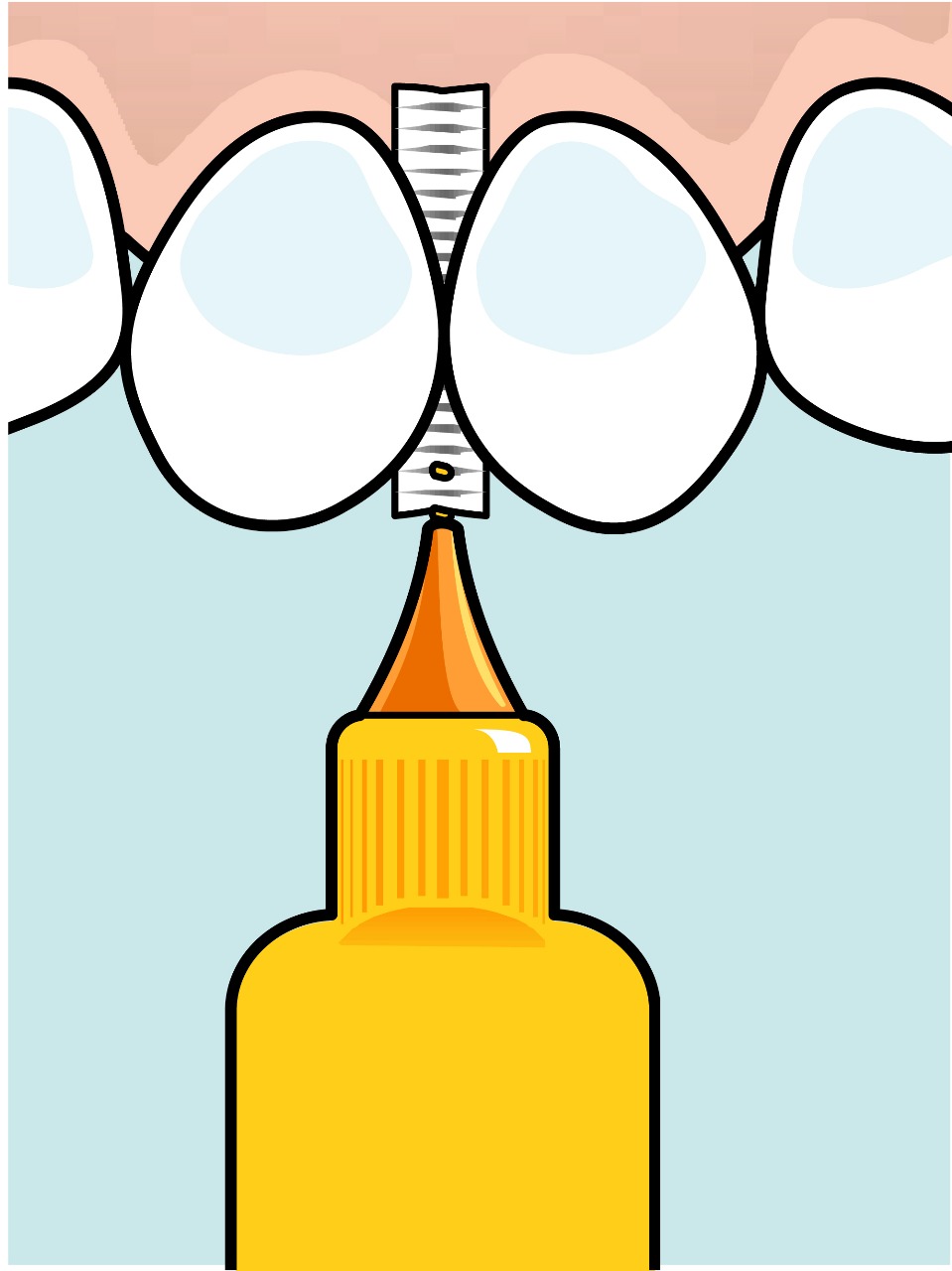 فرش مابين الأسنان فائقة النعومة IDB EXTRA SOFT RED