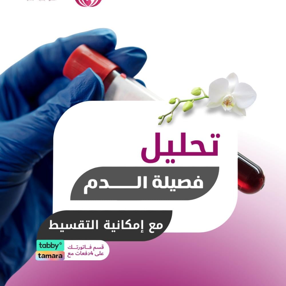 تحليل فصيلة الدم - مركز لؤلؤة العاج