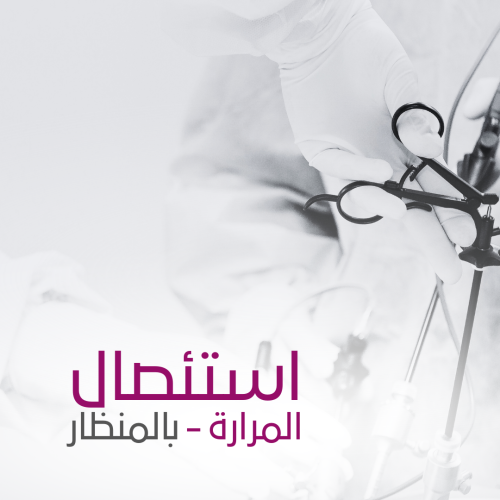 استئصال المرارة بالمنظار