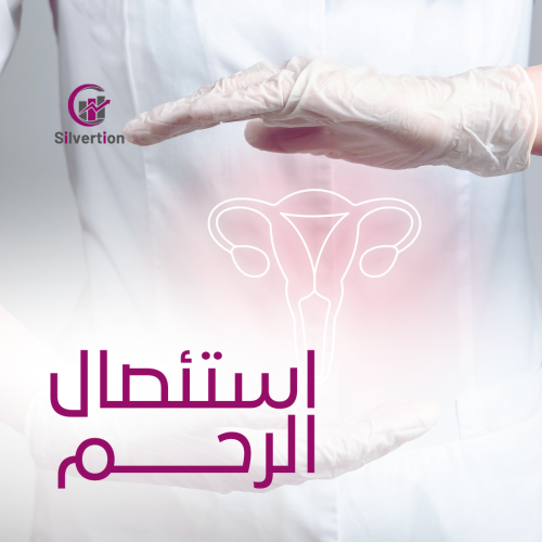استئصال الرحم