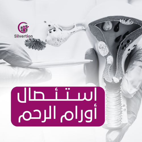 استئصال أورام الرحم