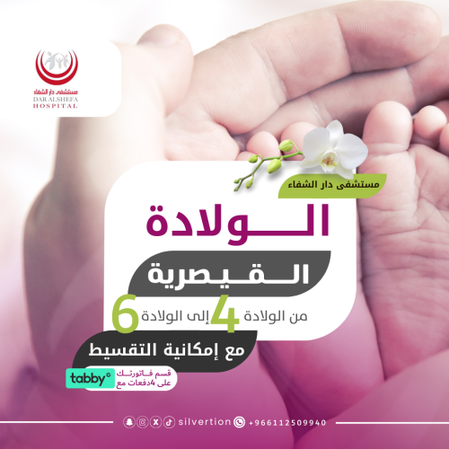 الولادة القيصرية من الرابعة وحتى السادسة - مستشفى...