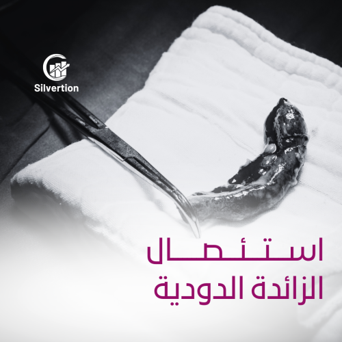 استئصال الزائدة الدودية - بالجراحة