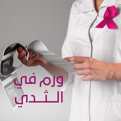 ورم في الثدي