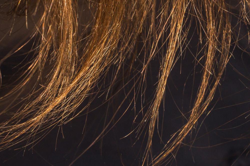 أفضل حلول للشعر الجاف والمتقصف في زاهي