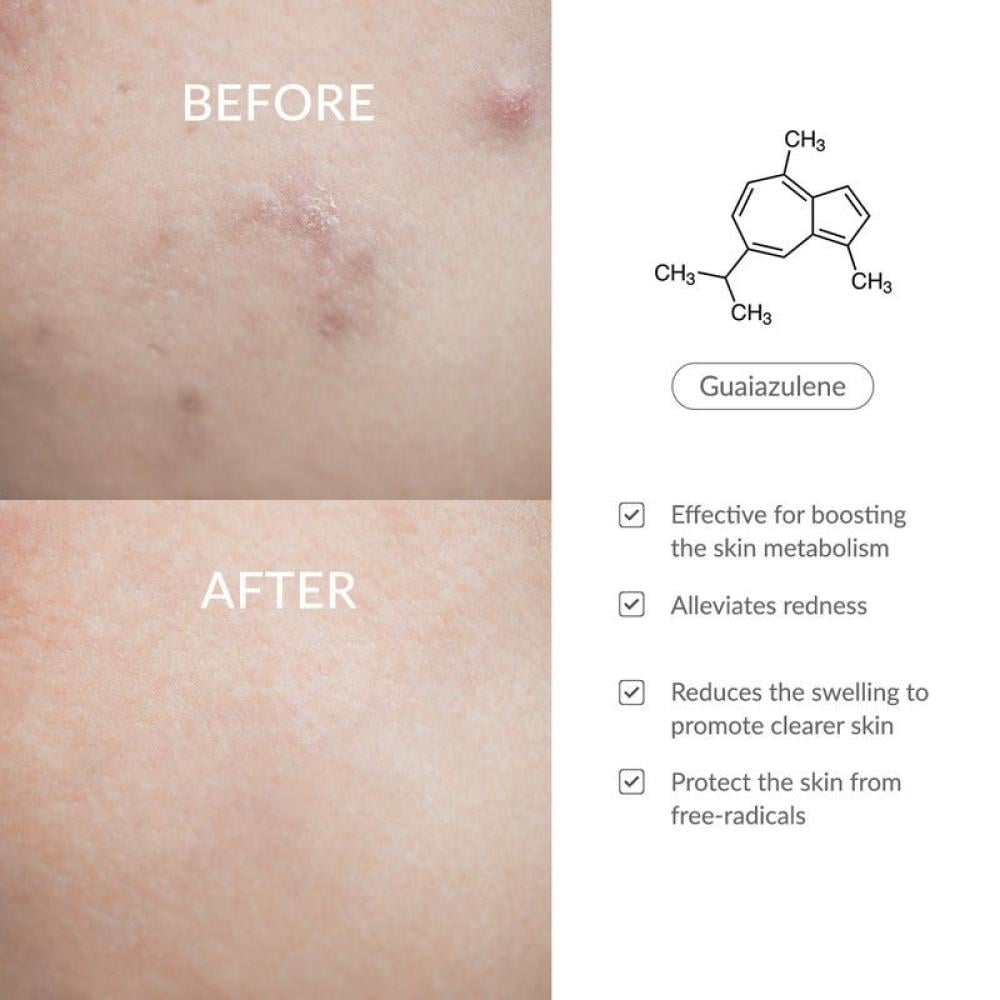 دكتور الثيا كريم 147 باريير ترطيب عميق وحماية فعّالة لحاجز البشرة 50 مل