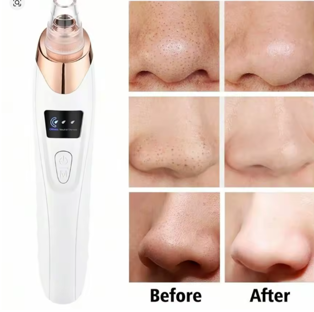 جهاز ازالة الرؤوس السوداء