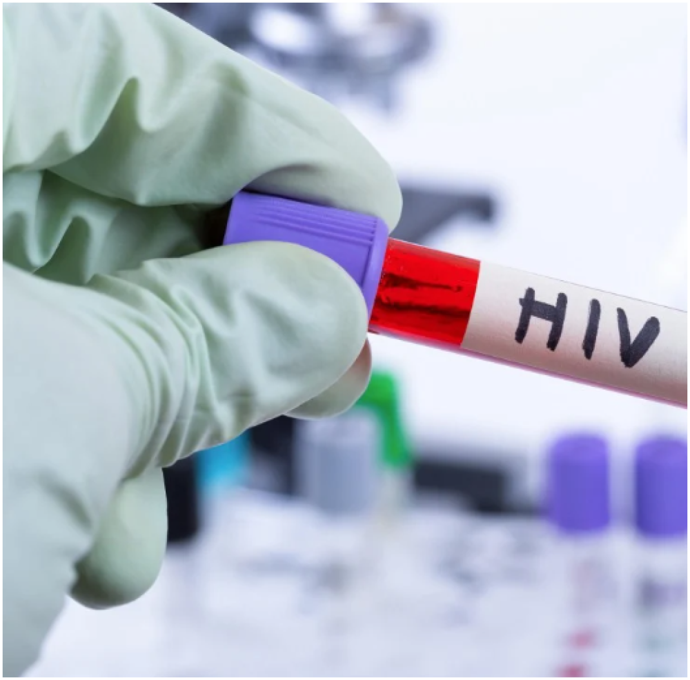 تحليل الأمراض الجنسية الشامل بدقة 99%