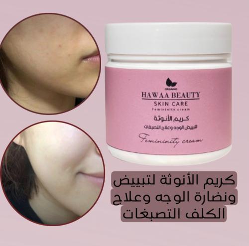 كريم الأنوثة لتبييض الوجه وعلاج الكلف السطحي والتص...