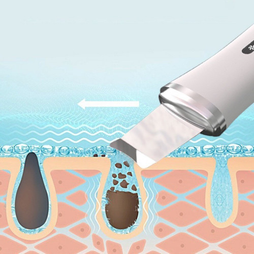 جهاز تنقية المسامات وتقشير البشرة