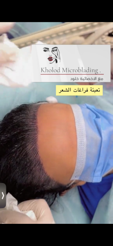 تعبئة فراغات الشعر