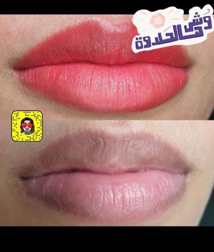 تصحيح وتوحيد شفايف