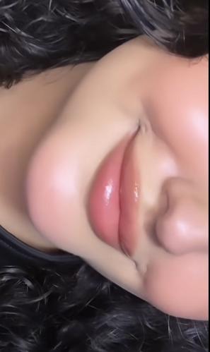 بلاشر خدود
