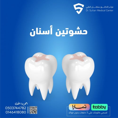 حشوتين أسنان