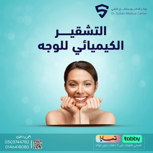 تقشير كيميائي للوجه