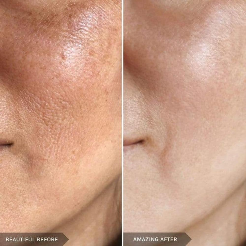 طرق تفتيح البشرة بأمان وتحسين لونها دون الإضرار بالحاجز الطبيعي