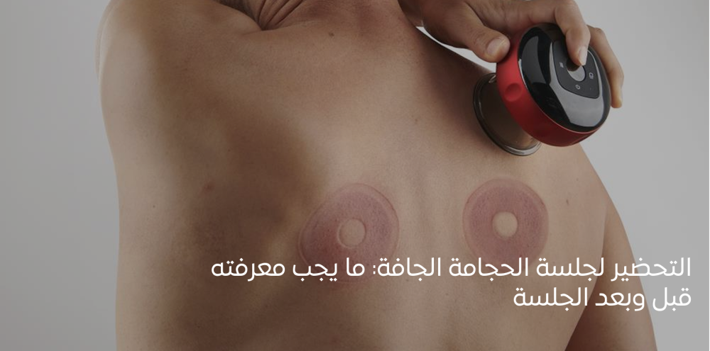 التحضير للحجامة الجافة