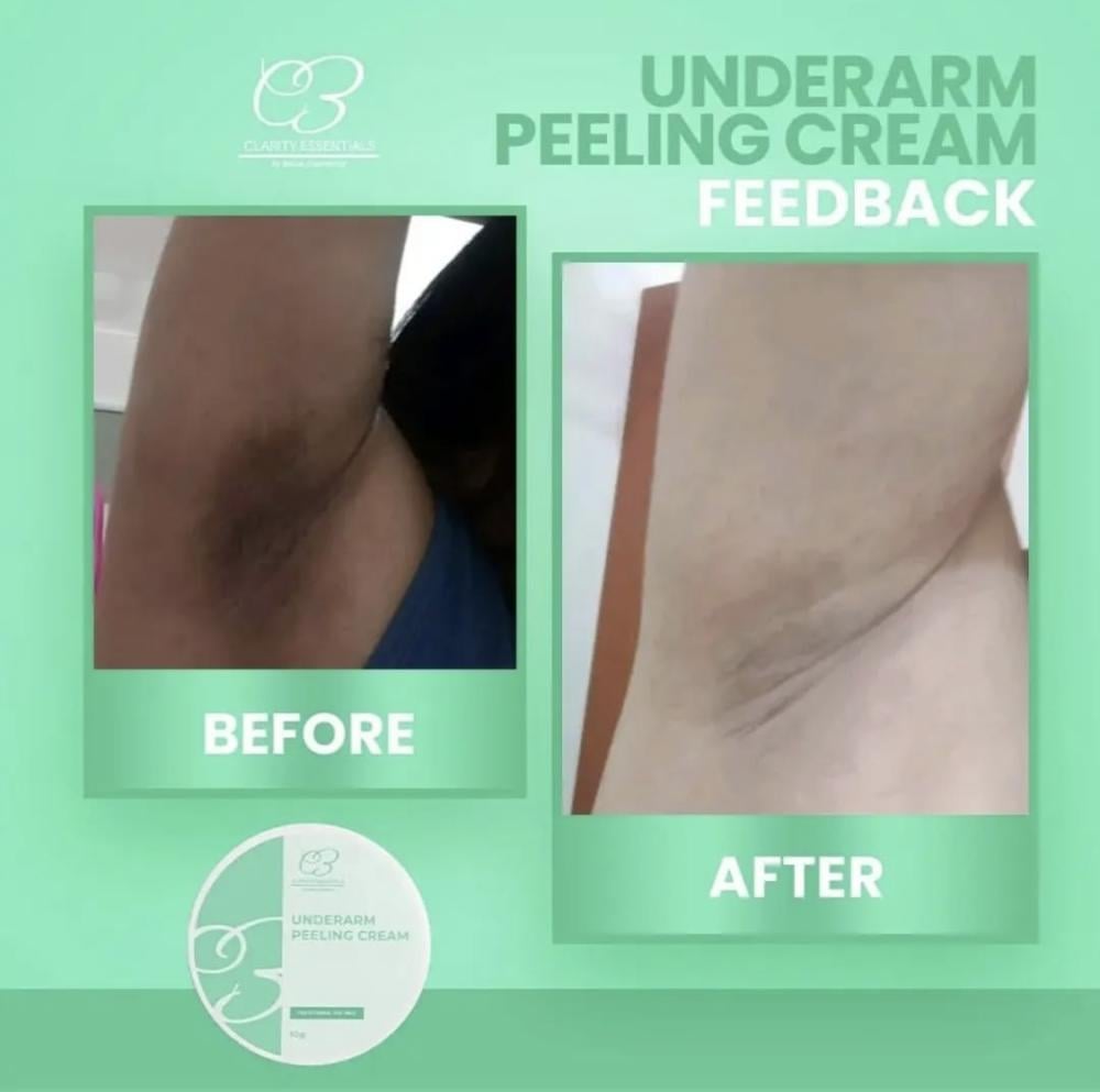 Clarity Essentials Underarm Whitening Cream