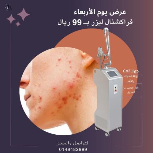 جلسة فراكشنال