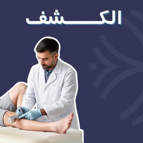 الكشف