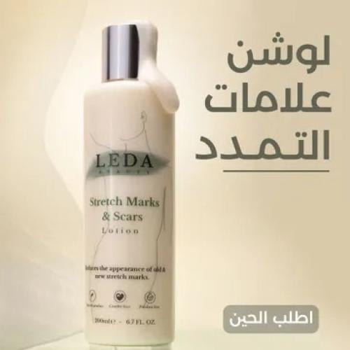 لوشن علامات التمدد