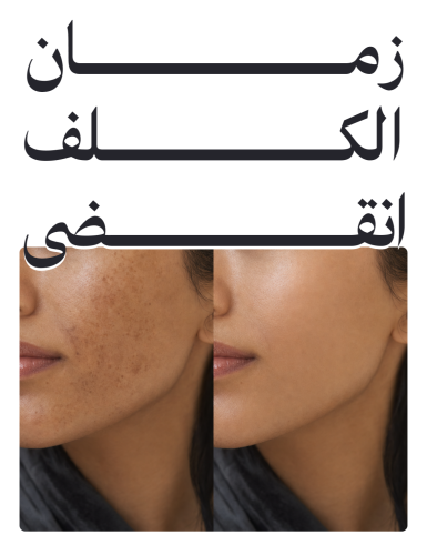 زمان الكلف انقضى