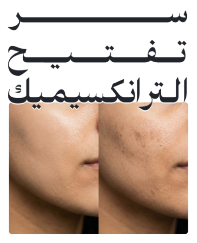 سر تفتيح مكون التراكسيميك آسيد
