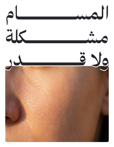 المسام مشكلة ولا قدر